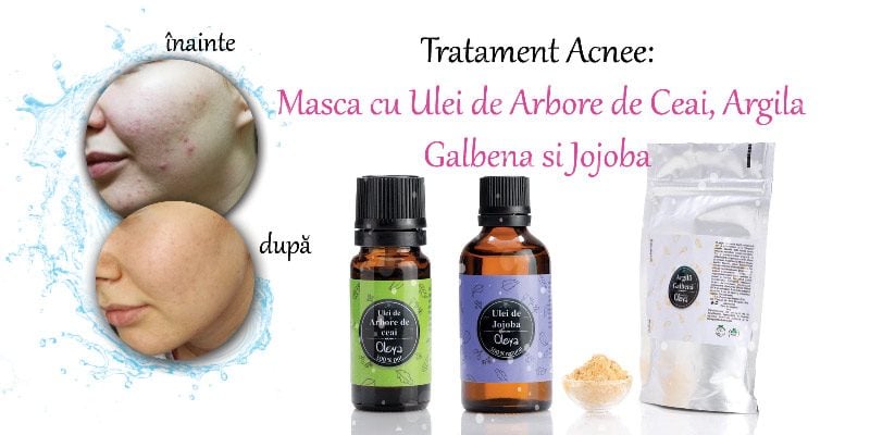 Acnee Vulgara Tratament Cu Arbore De Ceai și Jojoba Remedii Acnee