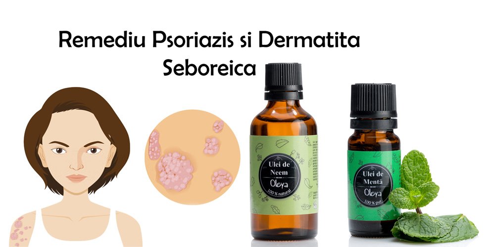 remediu psoriazis si dermatita seboreica